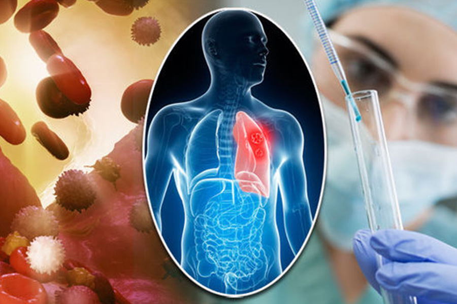 <span>Psiko-Onkoloji</span>ATOM ALDIKTAN SONRA (Hastane Odası İçin)